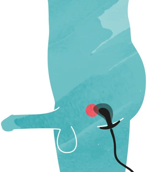 Inflatable Plug Inflatable Plug