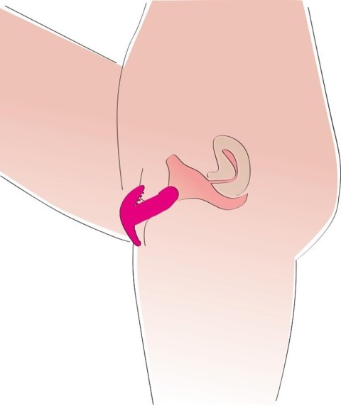My Little Secret silicone My Little Secret silicone
